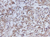 Anti-Human IL-17A Antibody - ABMIUM