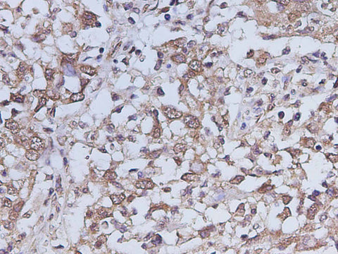 Anti-Human IL-17A Antibody - ABMIUM