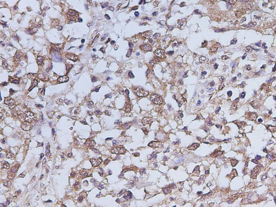 Anti-Human IL-17A Antibody - ABMIUM