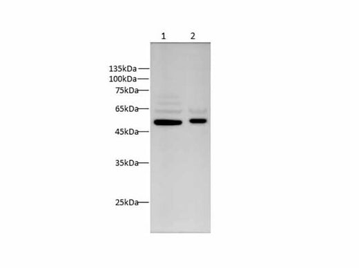 Anti-Human Vimentin Antibody - ABMIUM