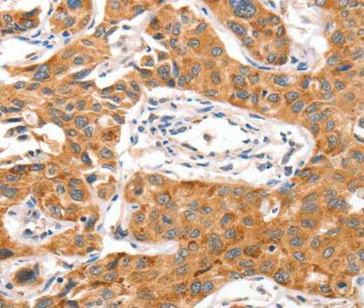 Anti-Human/Mouse NUAK1 Antibody