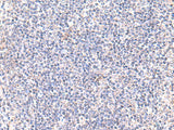 Immunohistochemistry of paraffin-embedded Human tonsil tissue using IFT57 Polyclonal Antibody at dilution of 1:85(×200)