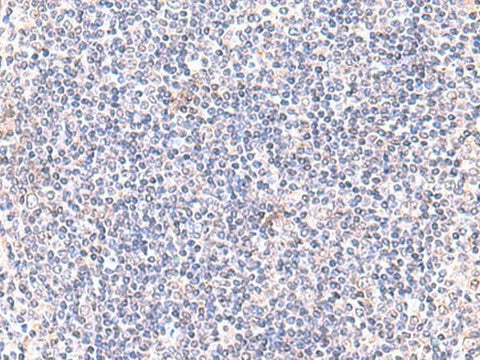 Immunohistochemistry of paraffin-embedded Human tonsil tissue using IFT57 Polyclonal Antibody at dilution of 1:85(×200)