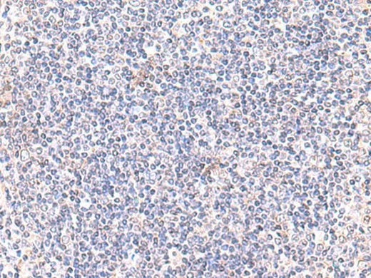 Immunohistochemistry of paraffin-embedded Human tonsil tissue using IFT57 Polyclonal Antibody at dilution of 1:85(×200)