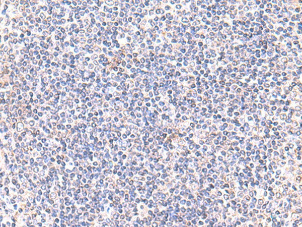 Immunohistochemistry of paraffin-embedded Human tonsil tissue using IFT57 Polyclonal Antibody at dilution of 1:85(×200)