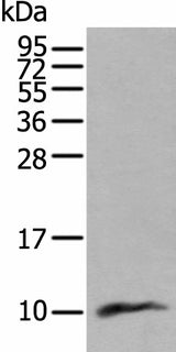 Western blot analysis of Human lung tissue lysate using CCL18 Polyclonal Antibody at dilution of 1:400