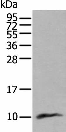 Western blot analysis of Human lung tissue lysate using CCL18 Polyclonal Antibody at dilution of 1:400