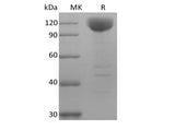 Recombinant Human Siglec-10 (C-Fc-Avi) Biotinylated - ABMIUM
