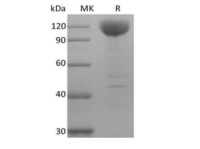 Recombinant Human Siglec-10 (C-Fc-Avi) Biotinylated - ABMIUM
