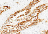 Anti-Human TACSTD2 Antibody [A1028] - ABMIUM
