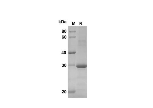SDS-PAGE analysis of Human CXCL3/CINC-2α/β proteins, 2 μg/lane of Recombinant Human CXCL3/CINC-2α/β proteins was resolved with SDS-PAGE under reducing conditions, showing bands at 30 kDa.