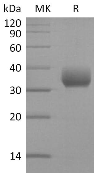 Recombinant SARS-CoV-2 Spike RBD (V341I)(His Tag) - ABMIUM
