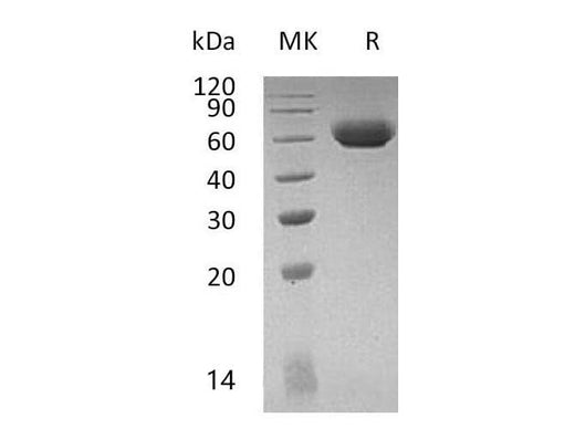 Recombinant Mouse LAG3 Protein (His Tag) - ABMIUM