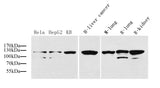 Western Blot analysis of various samples using COL1A1 Polyclonal Antibody at dilution of 1:1000.