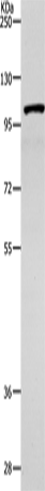 Anti-Human/Mouse/Rat TNK2 Antibody - ABMIUM