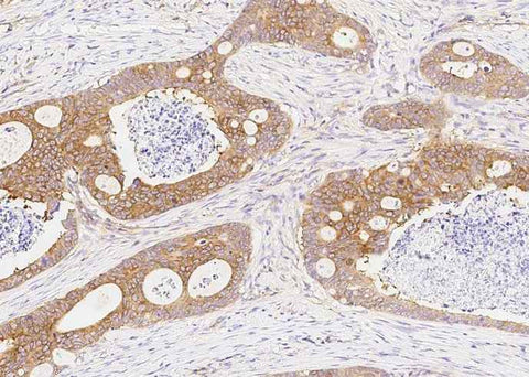 Anti-Human DARS Antibody [A1090] - ABMIUM