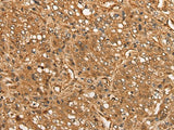 Anti-Human CALML6 Antibody - ABMIUM