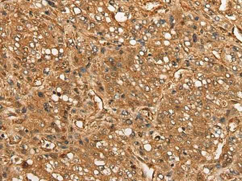 Anti-Human CALML6 Antibody - ABMIUM