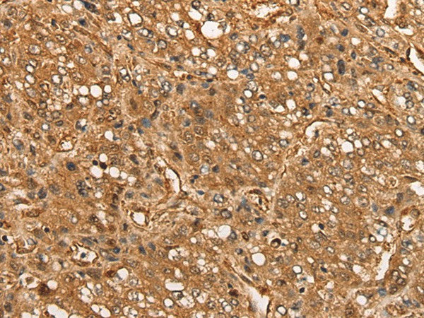 Anti-Human CALML6 Antibody - ABMIUM