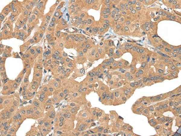 Anti-Human/Mouse/Rat PPP3R1 Antibody