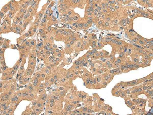 Anti-Human/Mouse/Rat PPP3R1 Antibody