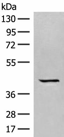 Western blot analysis of A549 cell lysate using GPR62 Polyclonal Antibody at dilution of 1:350