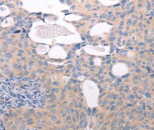 Anti-Human/Mouse/Rat ABCF1 Antibody