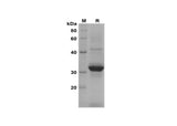 SDS-PAGE analysis of Mouse CCL12 proteins, 2 μg/lane of Recombinant Mouse CCL12 proteins was resolved with SDS-PAGE under reducing conditions, showing bands at 32 kDa.