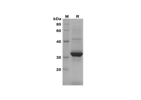 SDS-PAGE analysis of Mouse CCL12 proteins, 2 μg/lane of Recombinant Mouse CCL12 proteins was resolved with SDS-PAGE under reducing conditions, showing bands at 32 kDa.
