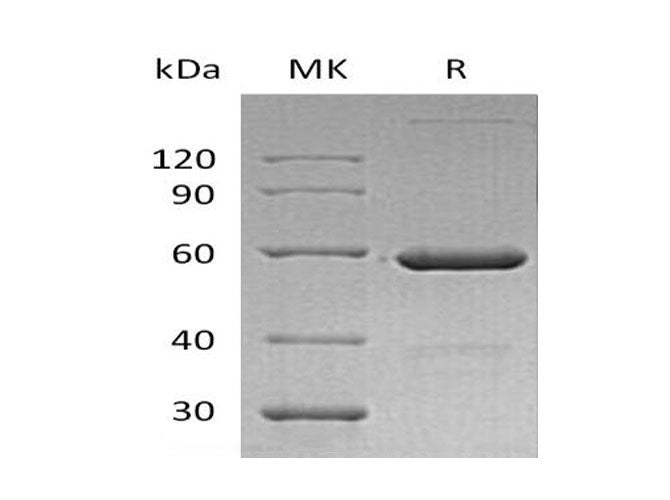 Recombinant Human VSIG8 Protein (Fc Tag) - ABMIUM