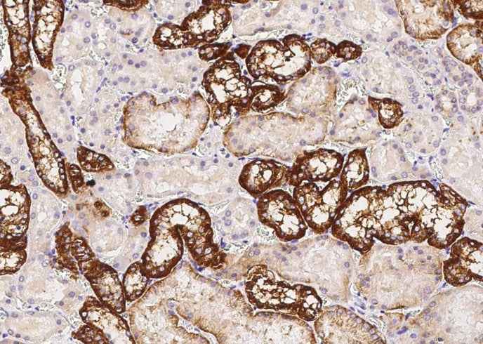 Anti-Human CDH16 Antibody [A1047] - ABMIUM