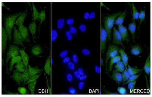 Immunofluorescence analysis of Anti-DBH Polyclonal Antibody