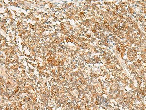 Anti-Human/Mouse/Rat JPT1 Antibody