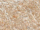 Immunohistochemistry of paraffin-embedded Human tonsil tissue using JPT1 Polyclonal Antibody at dilution of 1:35(×200)