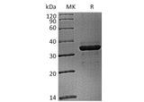 Recombinant Cynomolgus FGL1 (C-6His) - ABMIUM