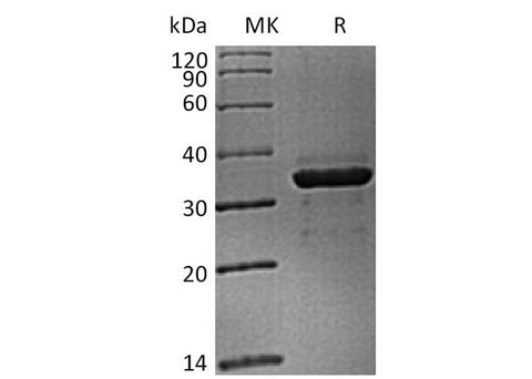 Recombinant Cynomolgus FGL1 (C-6His) - ABMIUM