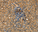 Anti-Human/Mouse/Rat ADCY3 Antibody - ABMIUM