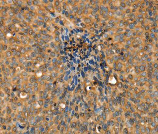 Anti-Human/Mouse/Rat ADCY3 Antibody