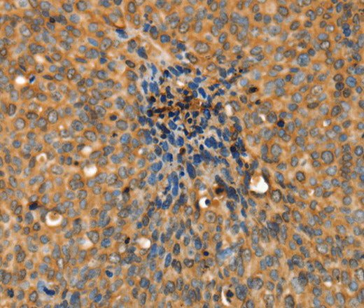 Anti-Human/Mouse/Rat ADCY3 Antibody - ABMIUM