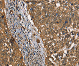 Anti-Human CSTB Antibody - ABMIUM