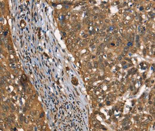 Anti-Human CSTB Antibody