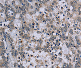 Anti-Human TP53AIP1 Antibody - ABMIUM