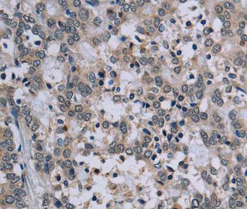 Anti-Human TP53AIP1 Antibody