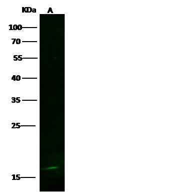 Anti-Human LSM1 Antibody [B373] - ABMIUM