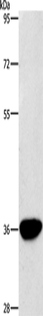 Anti-Human/Mouse/Rat AKR1D1 Antibody - ABMIUM