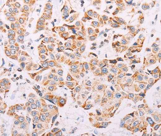 Anti-Human/Mouse ADAMTS16 Antibody