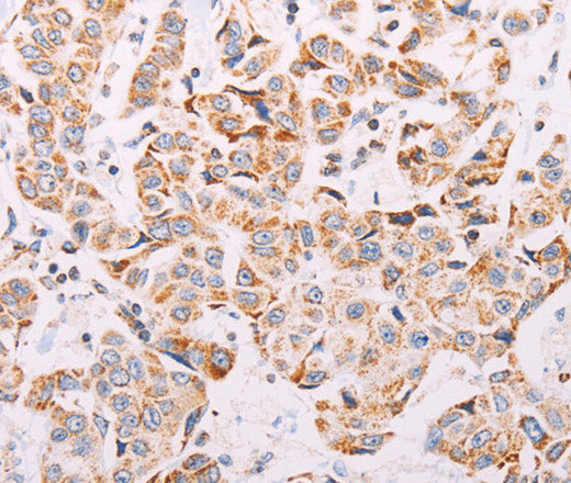 Anti-Human/Mouse ADAMTS16 Antibody - ABMIUM