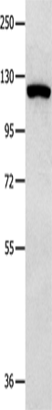 Anti-Human/Mouse/Rat MVP Antibody - ABMIUM