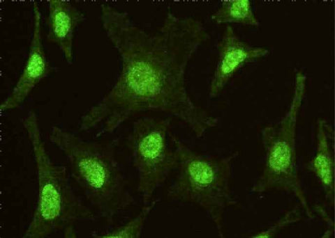 Anti-Human IRF6 Antibody [A1009] - ABMIUM