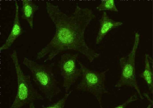 Anti-Human IRF6 Antibody [A1009] - ABMIUM